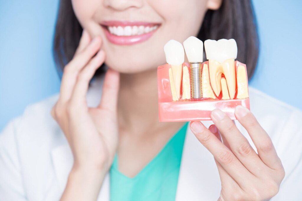 precios de los implantes dentales
