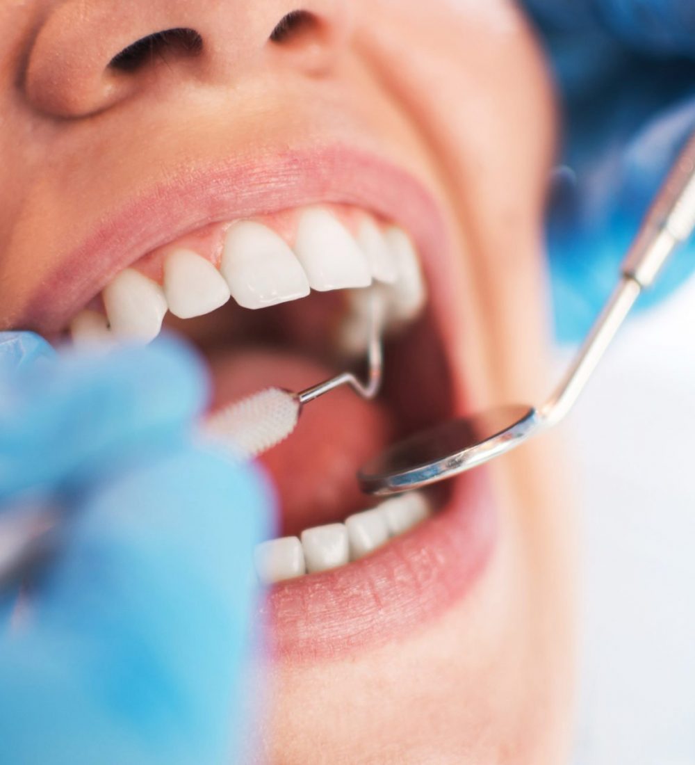 Endodontisk kirurgi