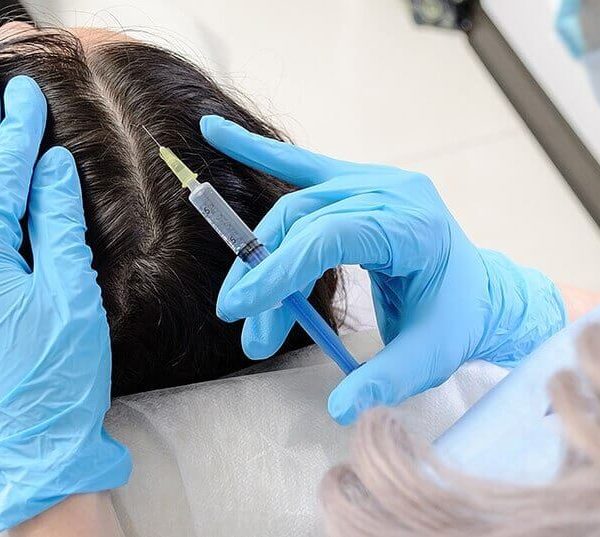 kvindelig hårtransplantation i tyrkiet