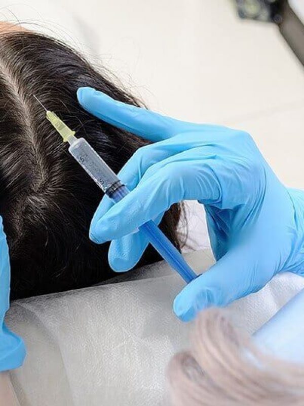 transplantation de cheveux chez la femme en turquie